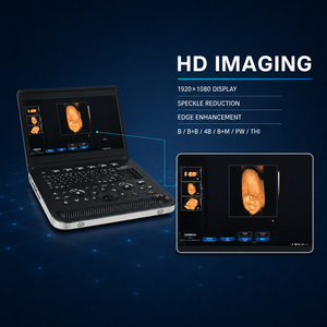 Escáner de Ultrasonido Veterinario, Equipo de Ultrasonido Médico con Sonda para el Departamento de Cardiología - Product Image 4