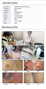 Máy Xóa Hình Xăm Bằng <span class=keywords><strong>Laser</strong></span> Pico Máy Xóa Hình Xăm Bằng <span class=keywords><strong>Laser</strong></span> Nd Yag Loại Bỏ Vết Rạn Da - Product Image 6