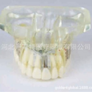Modèle d'enseignement dentaire Dt M2015, modèle d'implant médical anatomique en silicone pour les sciences médicales - Product Image 1