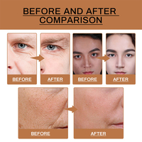 Sérum pour le visage pour hommes Collagène Acide hyaluronique Aloe vera & Anti-âge Raffermissant Réducteur de rides Hydratant Apaise les irritations quotidiennes