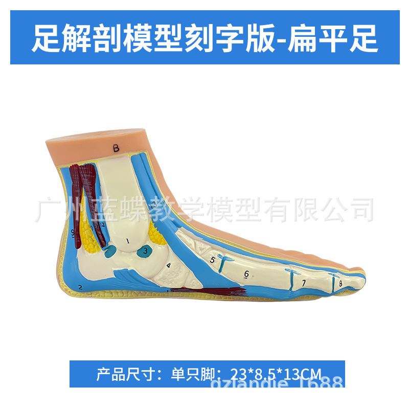 One flat-footed (engraved version)