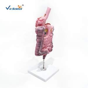 Modelo <span class=keywords><strong>de</strong></span> Enfermedad del Sistema Digestivo <span class=keywords><strong>de</strong></span> PVC, 2 Partes Desmontables, Estómago para Enseñanza <span class=keywords><strong>de</strong></span> Patología, CE ISO ROHS CNAS - Product Image 4