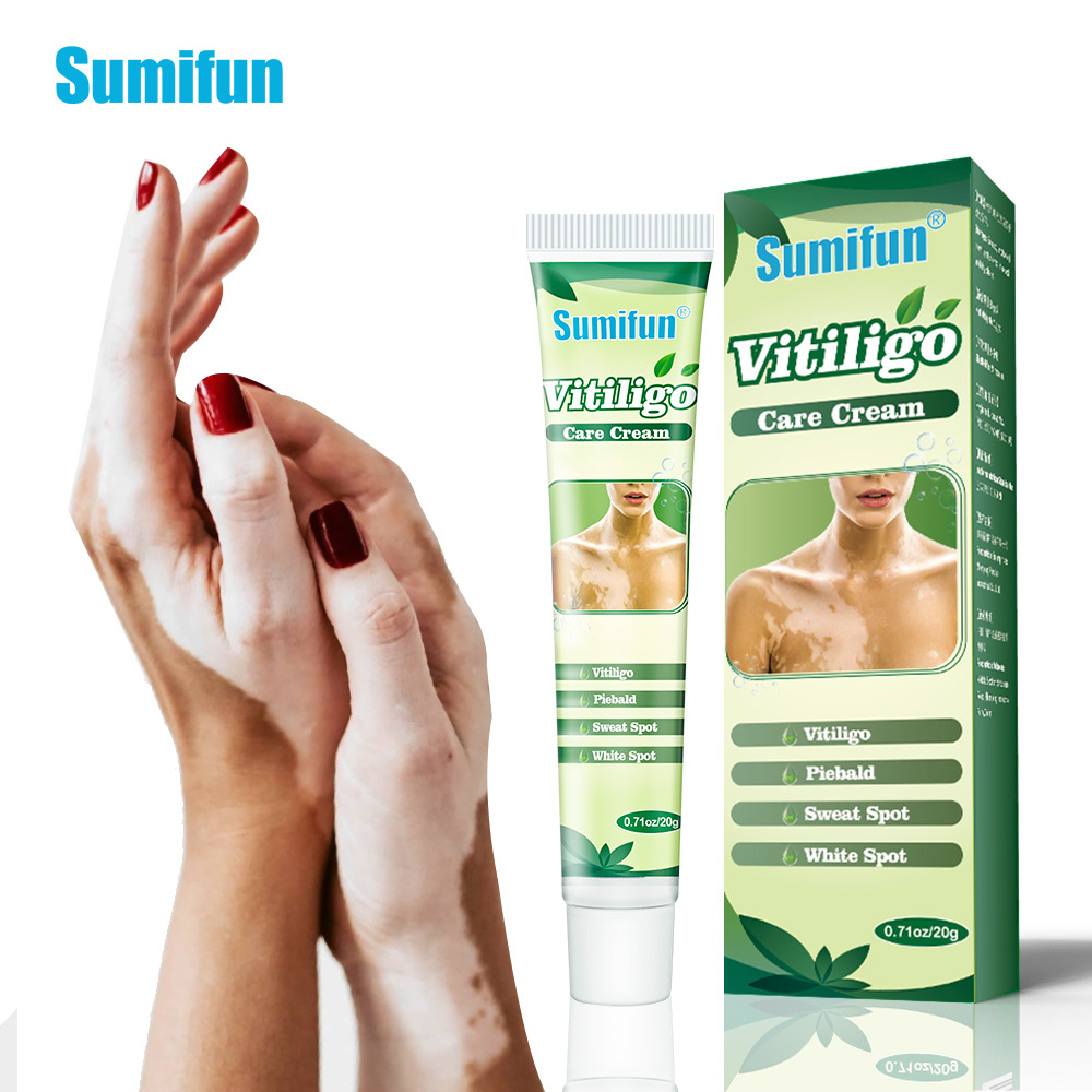 Hot sell White Spot Vitiligo Treatment Cream Herbal Vitiligo Therapeutic Creams Relieve Psoriasis Eczema Vitiligo Ointment