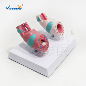 Suministro directo de fábrica de modelos de patología traqueal, hechos de material de PVC ecológico, claramente identificados, para laboratorio. - Product Image 2
