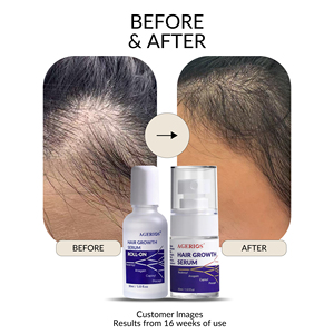 Sérum de croissance capillaire et du cuir chevelu avancé personnalisé 30 ml 3% Redensyl + 3% Procapil + 3% Anagain Naturel pour la <span class=keywords><strong>repousse</strong></span> des <span class=keywords><strong>cheveux</strong></span> professionnelle - Product Image 6