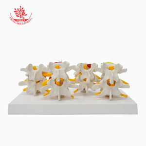 El modelo de columna vertebral humana FRT032 utiliza una vértebra lumbar normal y un modelo de lesión de hernia de disco intervertebral lumbar de 4 etapas. - Product Image 1