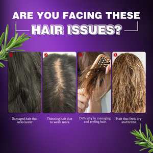 Savon revitalisant avec shampoing au romarin et oignon naturel endommagé pour tous les types de cheveux réparation lisse personnalisée en usine - Product Image 3