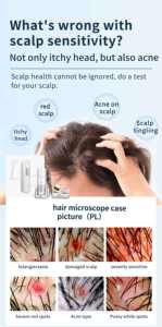 Analyseur de cheveux / Appareil d'analyse du cuir chevelu - Product Image 2