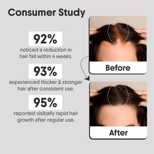 Siero Avanzato per la Crescita dei <span class=keywords><strong>Capelli</strong></span> Lance Etichetta Privata Stimola la Crescita Controlla la <span class=keywords><strong>Caduta</strong></span> Migliora la Densità Siero Organico per la Crescita dei <span class=keywords><strong>Capelli</strong></span> - Product Image 2