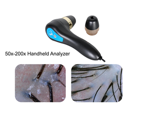 Machine d'analyse du cuir chevelu intelligente à IA de haute précision avec comparaison avant/après, détecteur de cuir chevelu - Product Image 6