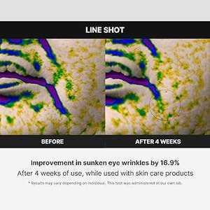 MEDICUBE AGE-R I-Shot 120g - Masajeador Facial y de Cuello Portátil para Rejuvenecimiento y Contorneado - Dispositivo de Belleza Coreano Más Vendido - Product Image 3