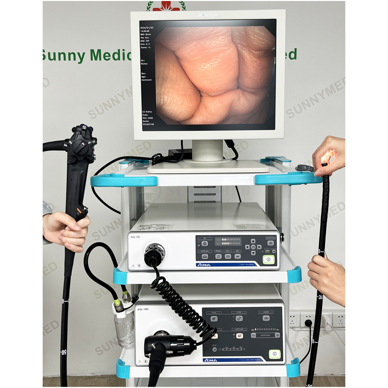 SY-P006-1 AOHUA AQ-100 HD Video Endoscopy for Animal Diagnosis