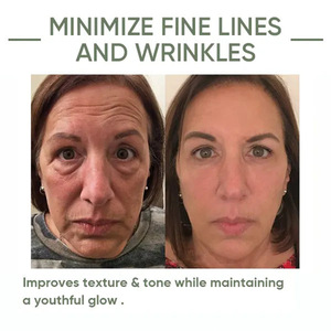 28 días reversión notable cuidado de la cara 100% suero de aguacate esencial puro esencia hidratante antienvejecimiento - Product Image 4