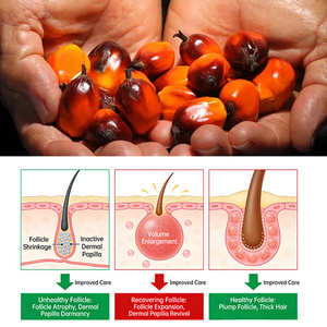Olio Essenziale <span class=keywords><strong>di</strong></span> Rosmarino Naturale e Biologico con Logo Personalizzato, Siero Nutriente per Cuoio Capelluto e Capelli, Olio <span class=keywords><strong>di</strong></span> Batana per la Crescita dei Capelli - Product Image 3
