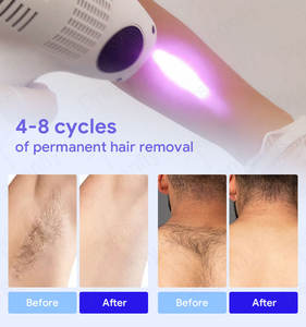 Ev ticari kullanım için 500W taşınabilir diyot lazer epilasyon makinesi hava/su soğutma sistemi 2 yıl garanti İngiltere uyumlu - Product Image 4