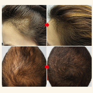 เซรั่มปลูกผมเร็วสูตรพรีเมียมจากธรรมชาติ ผลิตภัณฑ์สมุนไพรออร์แกนิคผสมน้ำมันขิง มะพร้าว และทีทรีออยล์ สำหรับซ่อมแซมเส้นผม (Private Label OEM) - Product Image 3