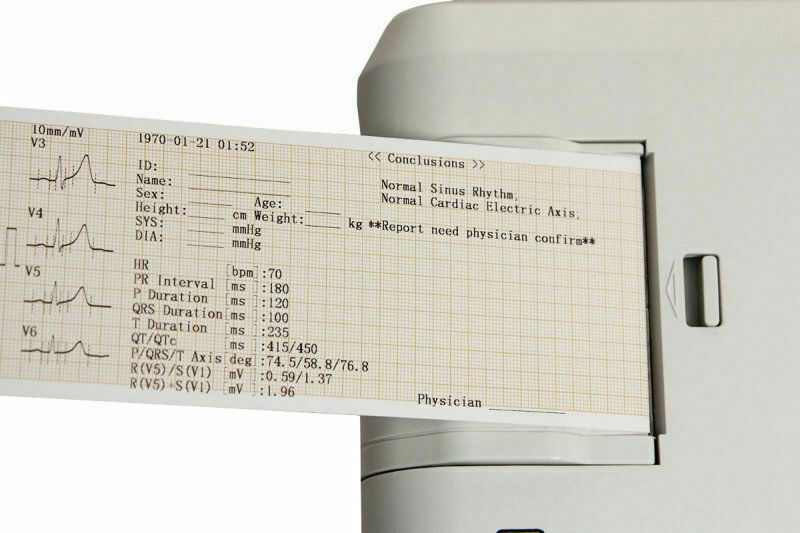 CONTEC ECG300G 3 channel Portable ecg monitor electrocardiography machine ekg ecg machines home ecg devices software Printer