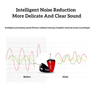 Acosound bằng sáng chế 8-kênh 100% vô hình có thể lập trình máy trợ thính cho thanh thiếu niên kích thước nhỏ hơn điếc Ruby IIC Tai & sản phẩm thính giác - Product Image 2