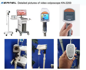Kernel KN-2200 HD <span class=keywords><strong>Video</strong></span> Colposcópio colposcópio digital para endoscópio ginecologia para câncer do colo do útero e rastreio do colo do útero - Product Image 6