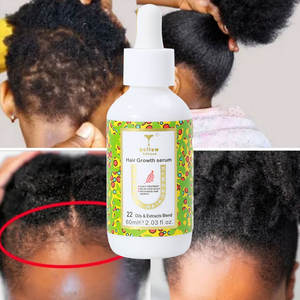Vente en gros de shampooings pour la pousse de cheveux noirs au gingembre et à la biotine Ensembles d'après-shampooings à la menthe Shampooing et sérum à l'huile pour la pousse des cheveux - Product Image 5