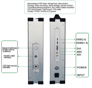 Système de caméra endoscopique portable tout-en-un, dispositifs médicaux professionnels, écran 4K avec moniteur et source lumineuse - Product Image 5