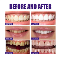 2026 Marque OEM Dentifrice Mousse Sérum V34 Saveur Menthe, Correcteur de Couleur à Résultats Rapides pour Dents Sensibles, Caractéristique Naturelle