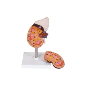 50109.03 Model of human kidney with adrenal gland