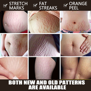 Vitamina C escualano de alta calidad, reparación fuerte de marcas de embarazo, eliminación de cicatrices de acné de crecimiento, crema para eliminar estrías - Product Image 3