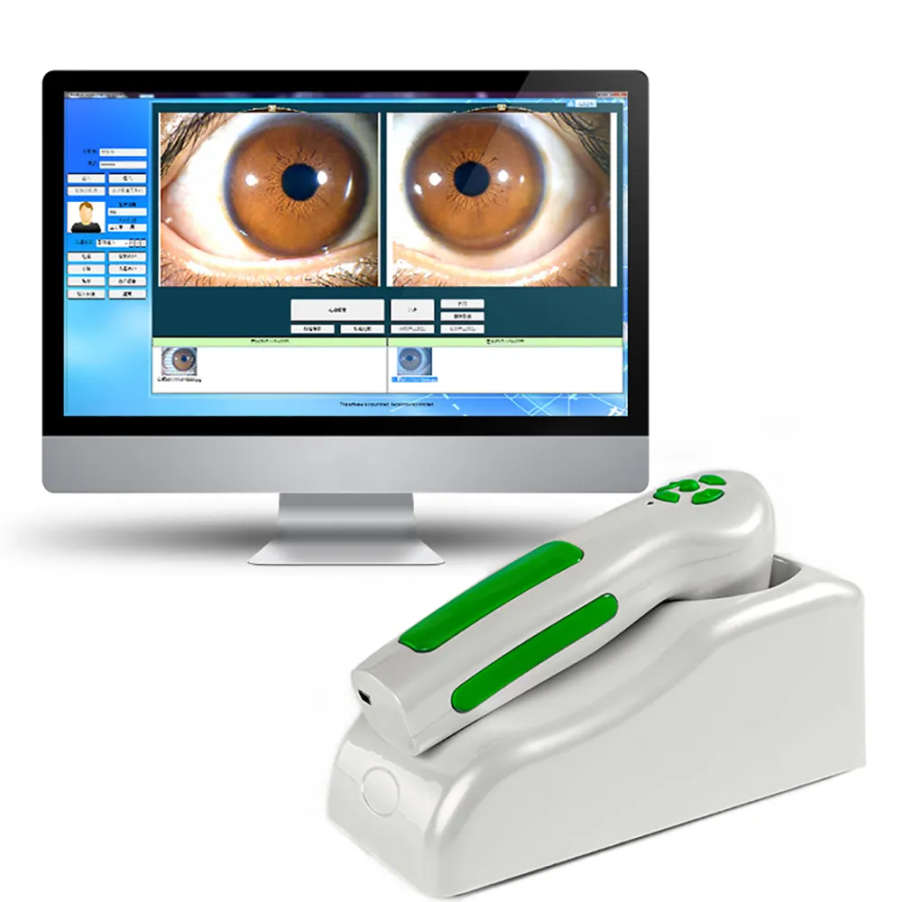 ماسح قزحية العين ثلاثي الأبعاد للاستخدام السريري ومحلل قزحية العين للتشخيص الصحي باستخدام البرامج