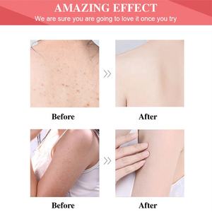 Private Label Natuurlijk Fruit Doordrenkt Watermeloen Shea Boter Parel Kruidenperzik Citroen Kokos Honing Veganbody <span class=keywords><strong>Scrub</strong></span> - Product Image 5