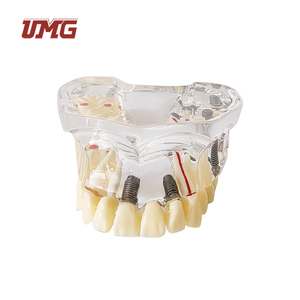 Modelo de Dientes de Práctica para Implantes Dentales UMG UM-2006, Mandíbula Inferior, para Incisión y Perforación, Calidad Superior Duradera - Product Image 1