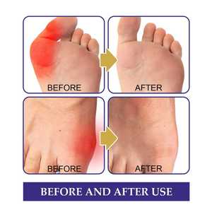 5PCSパック外反母趾鎮痛パッチ関節つま先のこわばり炎症リウマチプラスターアーチ型外反母趾鎮痛ステッカー - Product Image 4
