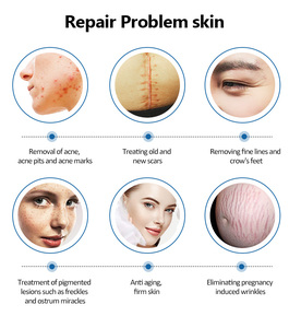 Approvisionnement d'usine CO2 Fractional Laser Machine Laser Tube 60W Rajeunissement de la peau Serrage de la peau laser machine - Product Image 3