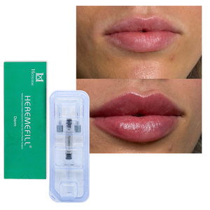 Prix surprise - 2 ml d'<span class=keywords><strong>acide</strong></span> <span class=keywords><strong>hyaluronique</strong></span> pour le remplissage des lèvres, augmentation des lèvres, <span class=keywords><strong>injection</strong></span> pour l'élargissement des lèvres - Product Image 5