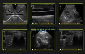 Ecógrafo Doppler Color Portátil al Mejor <span class=keywords><strong>Precio</strong></span>, con PDI, Dispositivo de Ultrasonido General para Diagnóstico Hospitalario, Ecografía CU09 - Product Image 6