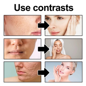 MRUIS Skin Brightening <span class=keywords><strong>Limpiador</strong></span> facial Exfoliante Lavado de <span class=keywords><strong>cara</strong></span> que contiene vitamina C Vitamina E 100mL Uso en el hogar - Product Image 4