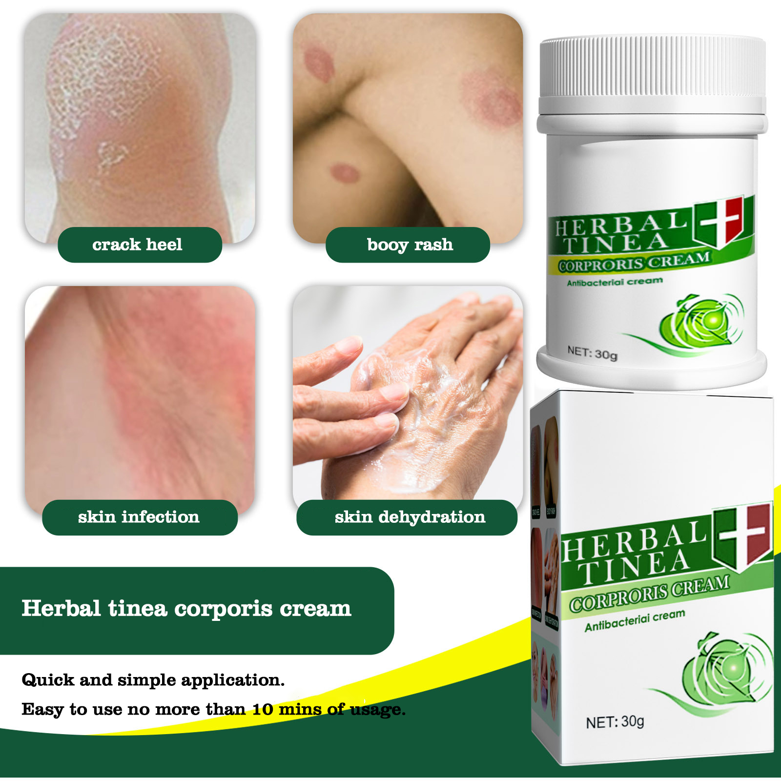 body cream itching care topical herbal tinea cream itching ringworm ointment