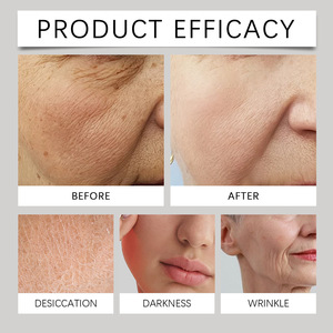 Crema Facial Hidratante con Cápsulas de Vitamina C <span class=keywords><strong>EELHOE</strong></span>, Crema Facial Nutritiva e Iluminadora, 50g - Product Image 6