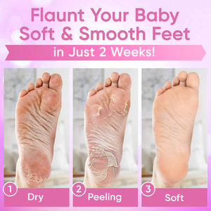 Masque pour les pieds à <span class=keywords><strong>la</strong></span> rose-Lot de 3 masques exfoliants pour les pieds secs et fissurés, les callosités et les peaux mortes-281272 - Product Image 3