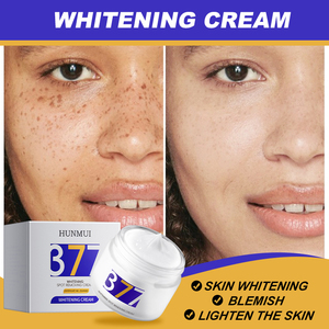 Crema Facial Blanqueadora para Eliminar Manchas Oscuras y Pecas, Reduce Melasma - Product Image 5
