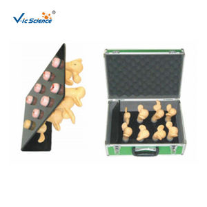 Modelo Anatómico de Lesiones Cervicales Uterinas de 8 Piezas para Entrenamiento de Enfermeras y Escuelas de Medicina - Product Image 1