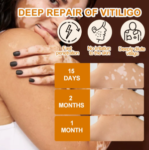 Ungüento para Eliminar Efectivamente el Vitiligo, Elimina la Tiña y las Manchas Blancas, Producto para el Cuidado de la Piel con Vitiligo - Product Image 2