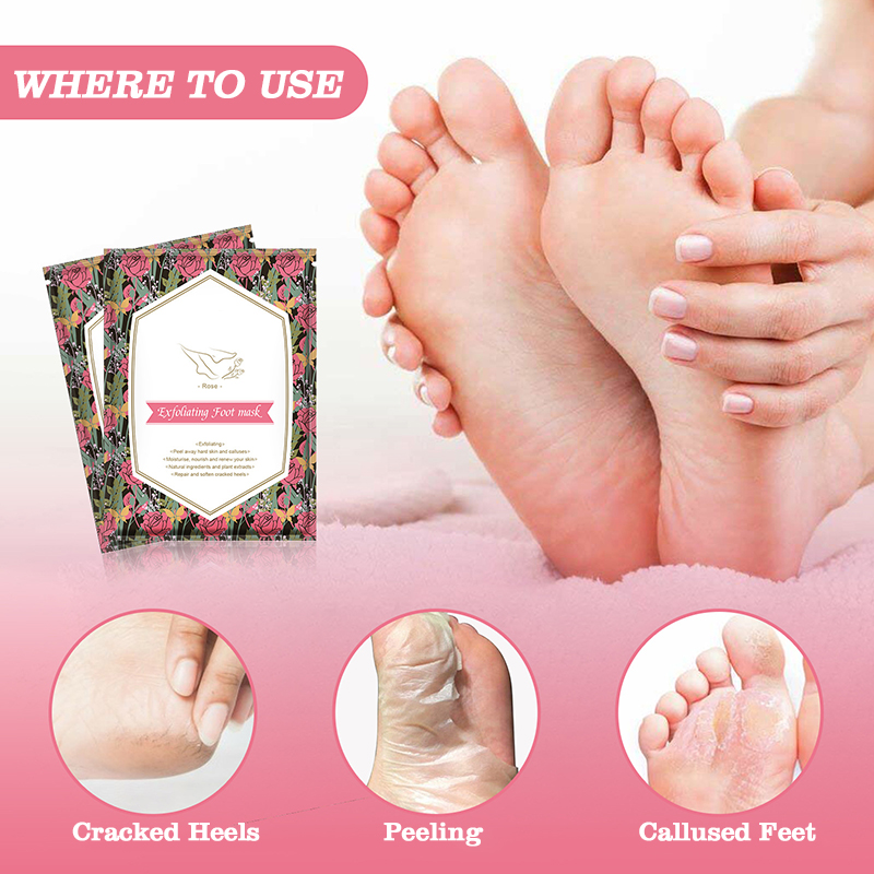 wholesale custom fruits natural foot mask sock peeling moisturizing exfoliating rose foot peel mask