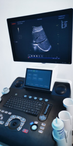 Système d'échographie <span class=keywords><strong>Doppler</strong></span> couleur numérique pour la surveillance fœtale, scanner d'échographie diagnostique obstétrique/gynécologique - Product Image 5