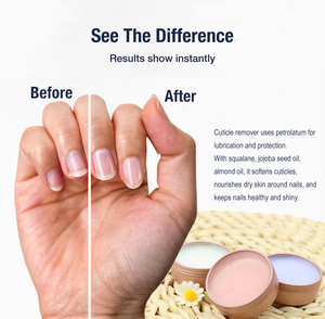 Crème pour cuticules sèches et abîmées : Baume hydratant pour les soins des ongles, éliminateur de cuticules pour les mains rugueuses, les pieds gercés et rigides - Product Image 5