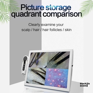 Analyseur de Cuir Chevelu et de Follicules Capillaires de Qualité Professionnelle pour Salons – Disponible à la Vente - Product Image 4