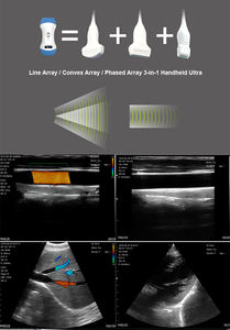 Ecógrafo Veterinario Inalámbrico 3 en 1 de Alta Calidad con 192 Elementos, Portátil, con Material ABS para Uso en Salón - Product Image 4