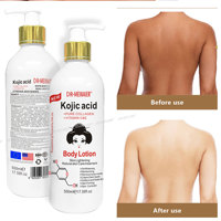 Lotion pour le corps 500 ml, soin du corps, vitamine C et E, élimine les taches brunes, nourrissante, blanchissante longue durée, lotion pour le corps à l'acide kojique pour peaux noires