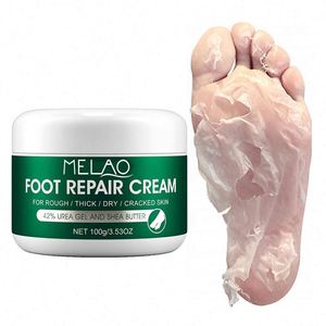 Crema per la riparazione del piede per rimozione del callo sollievo rapido per una benda in Gel per gli occhi con <span class=keywords><strong>piedi</strong></span> e talloni secchi, screpolati e pruriginosi - Product Image 5