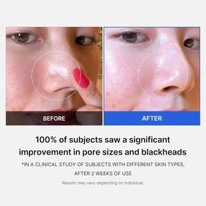 Medicube Zero Pore Pad Esfoliante per la Cura dei Pori con AHA e BHA, Cura della Pelle Coreana, Acido Salicilico, Acido Succinico Rosso, Pad Esfoliante 155g - Product Image 2